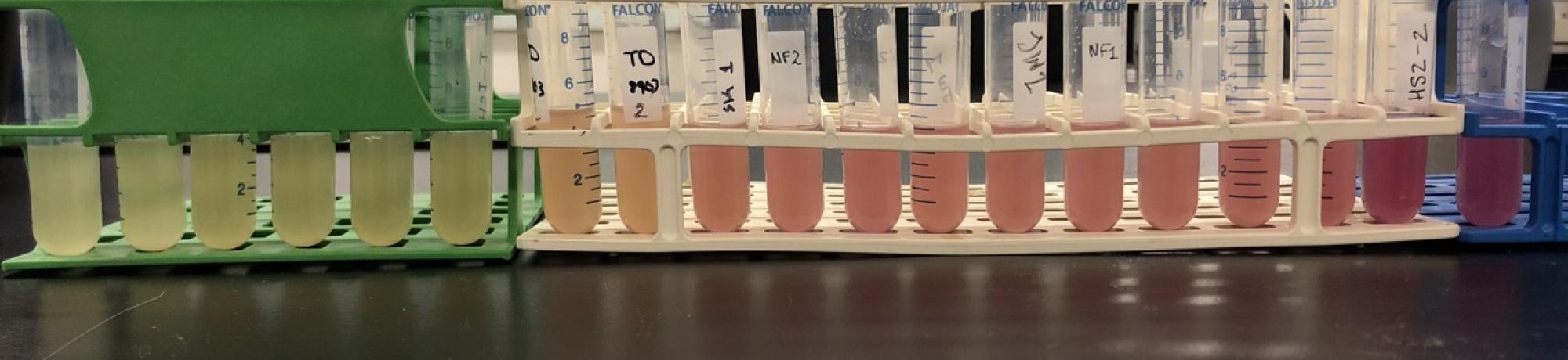 Student engineered promoter mutants displaying different levels of RFP expression.
